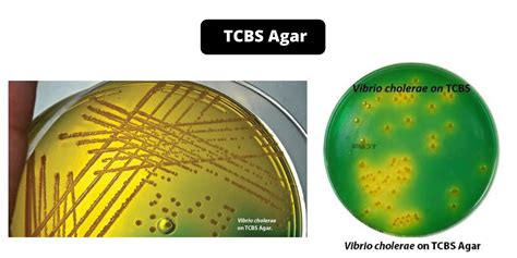 tcbs agar composition